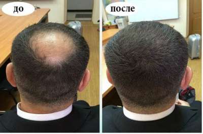 Инновационное средство!!!