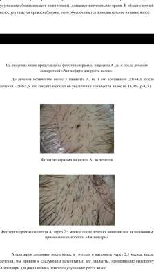 Сыворотка для роста волос в Краснодаре фото 3